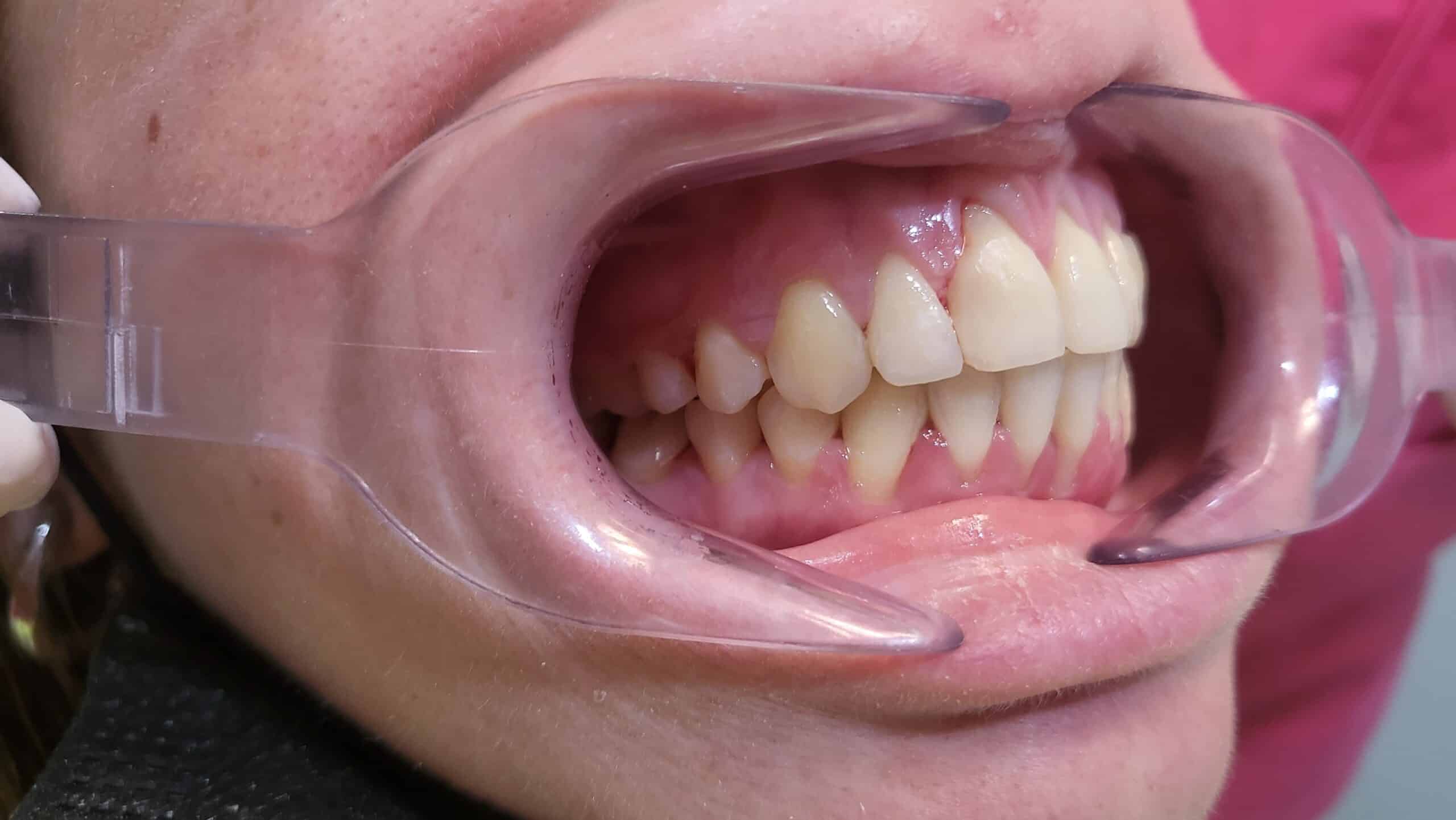 Sonrisa brillante y saludable, ejemplo inspirador