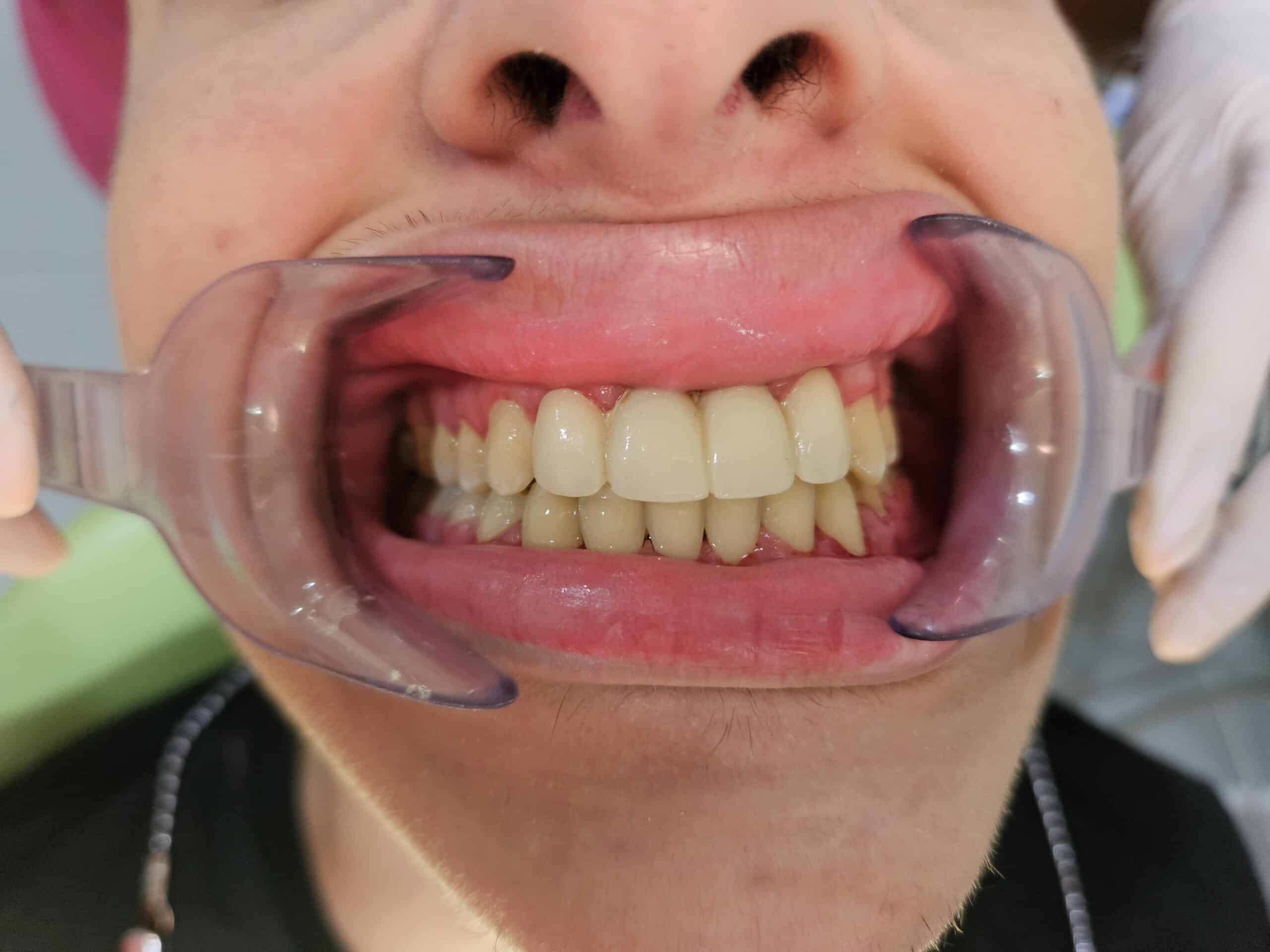 Ortodoncia avanzada en El Raal